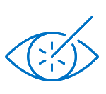 CATARACT